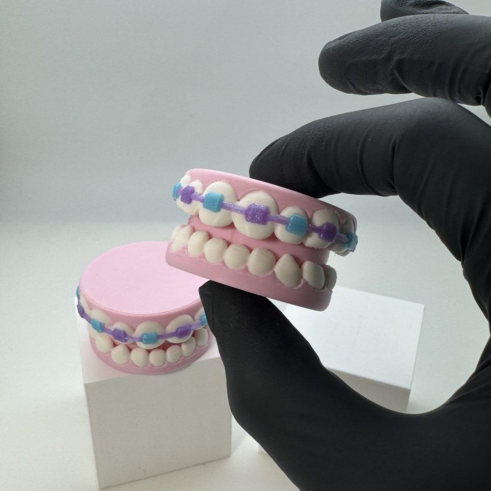 Braces Fidget Clicker 3D Print