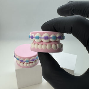 Braces Fidget Clicker 3D Print